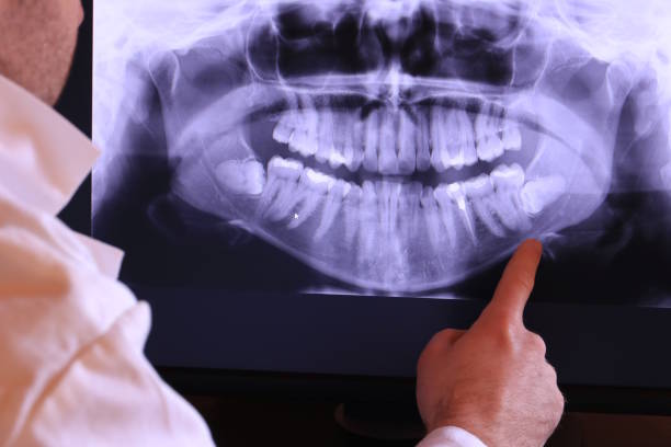 Best Same-Day Emergency Dentist in Ridgeway, VA