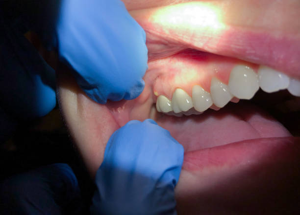 Best Same-Day Emergency Dentist in Ridgeway, VA