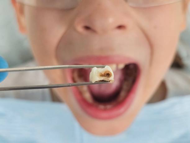 Best Urgent Dental Care in Ridgeway, VA